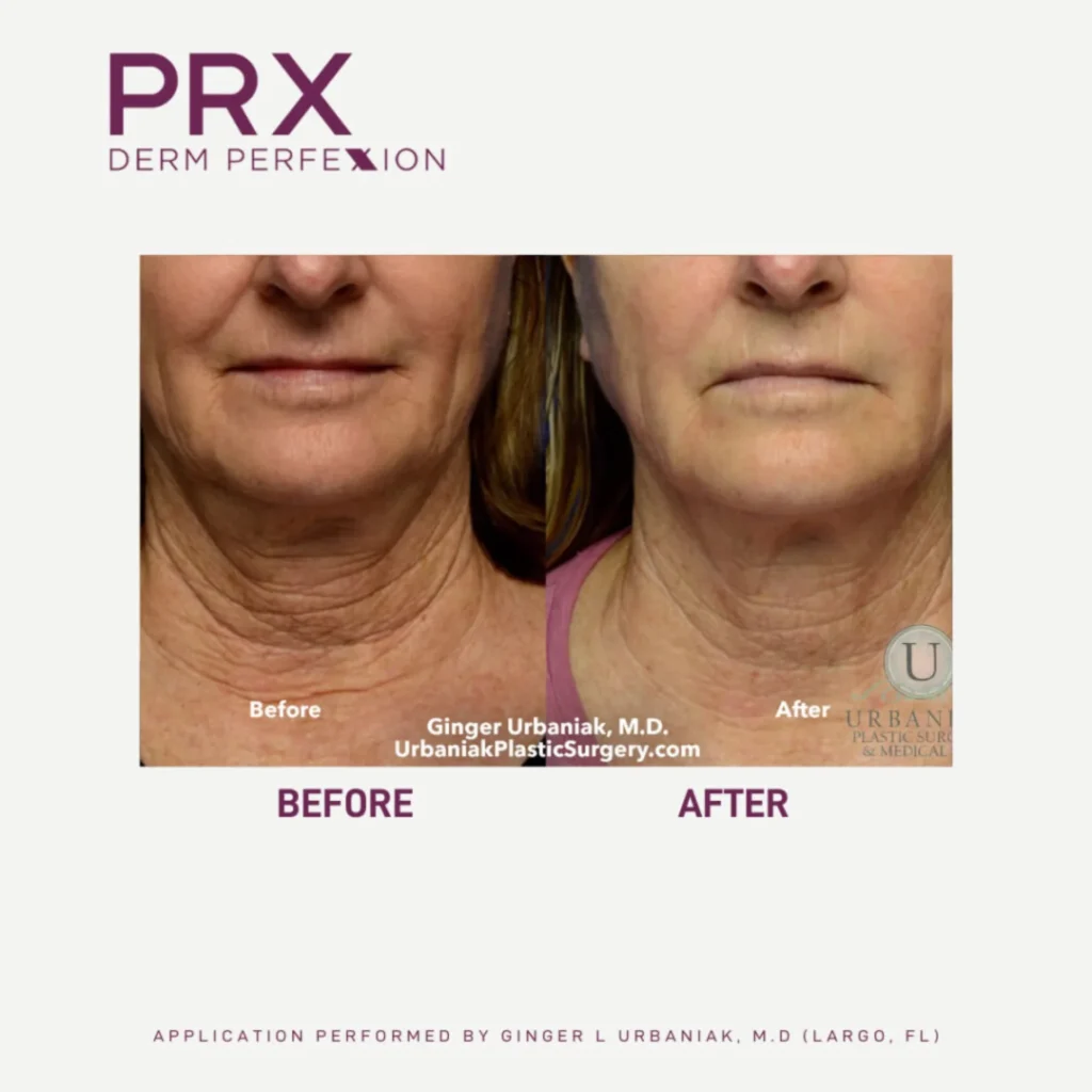 Skin Tightening Park City