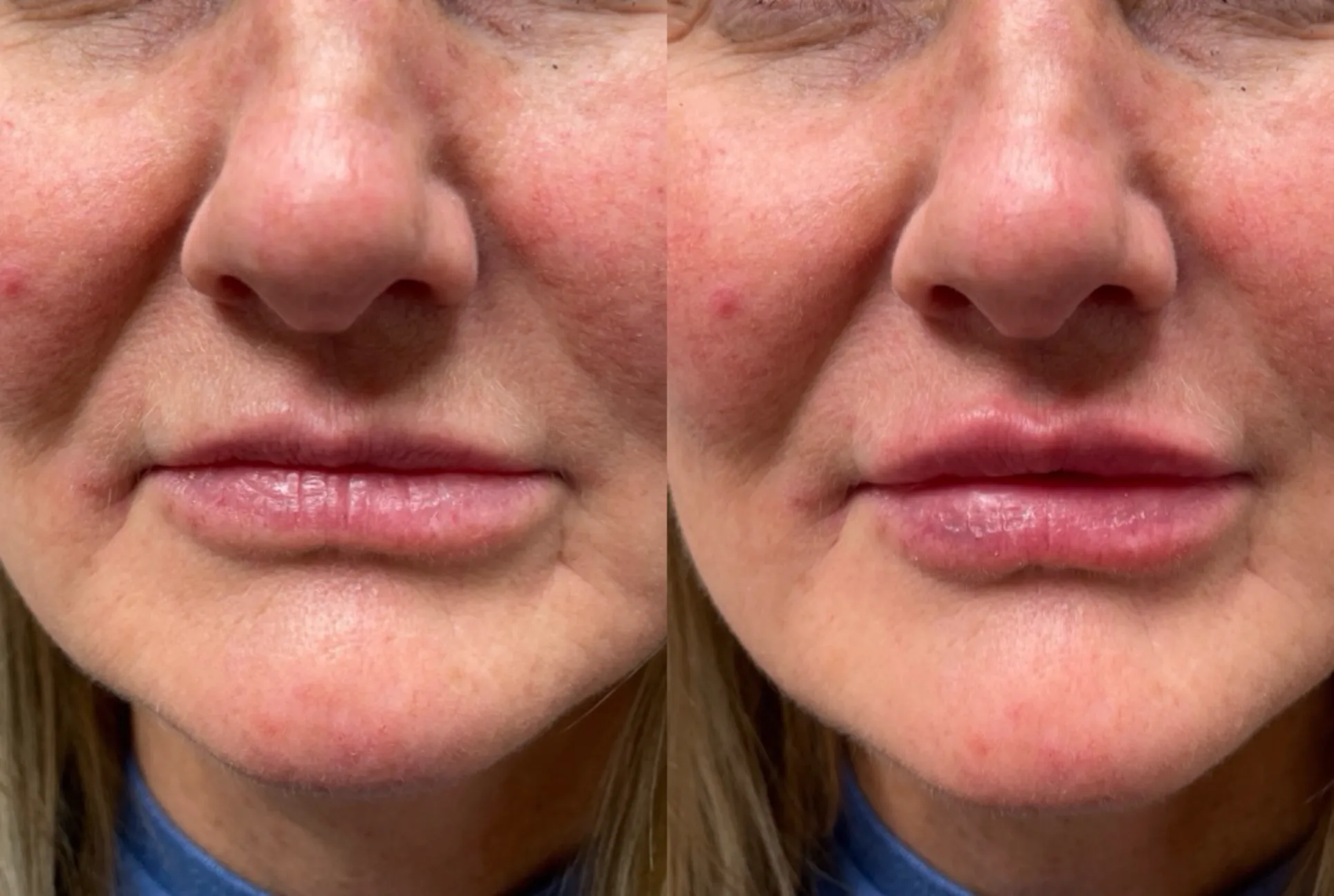 Aesthetic Treatments Park City