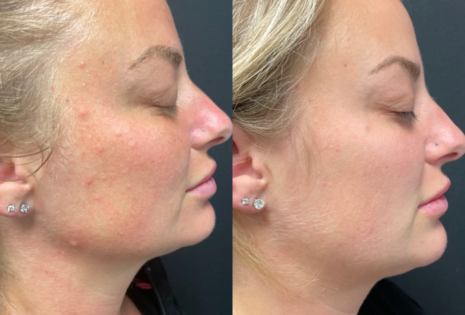 Aesthetic Treatments Park City