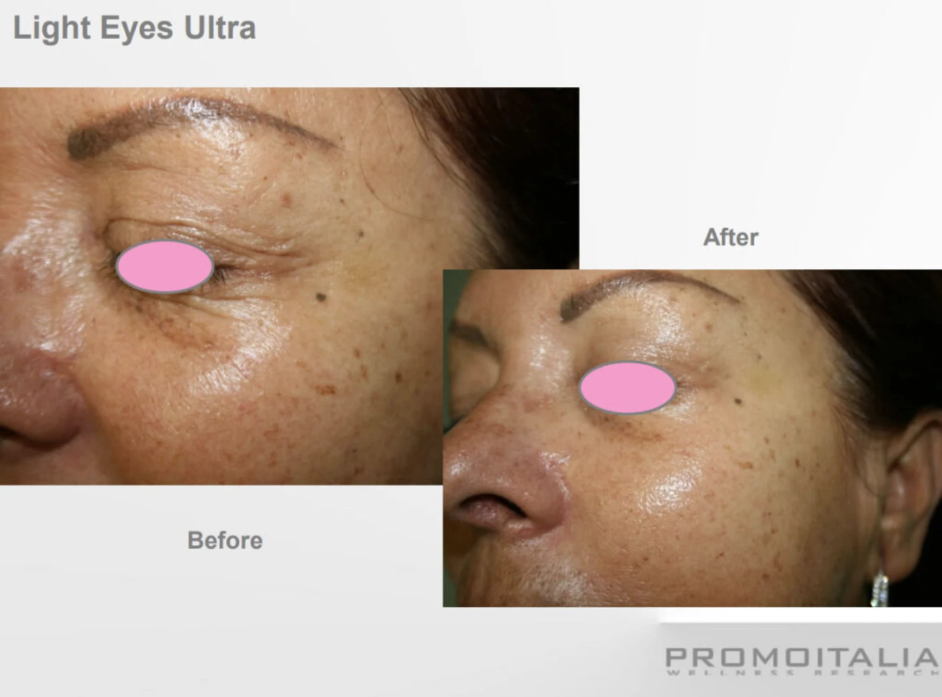 Cosmetic Procedures Park City