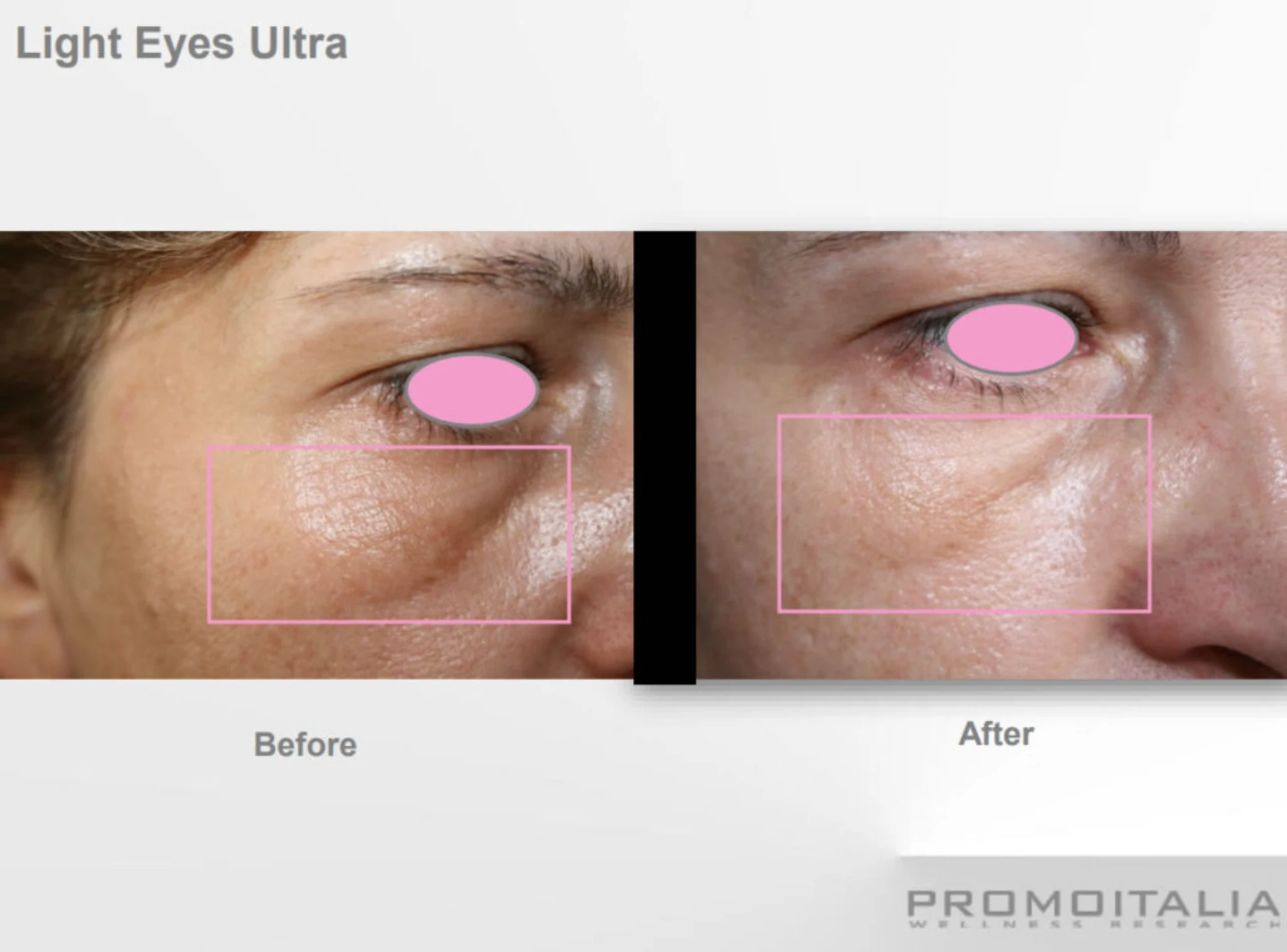 Cosmetic Procedures Park City