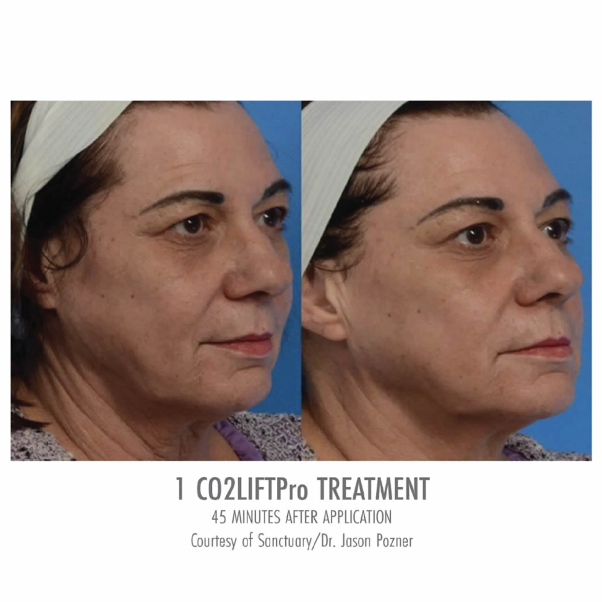 CO2 Lift Pro Park City