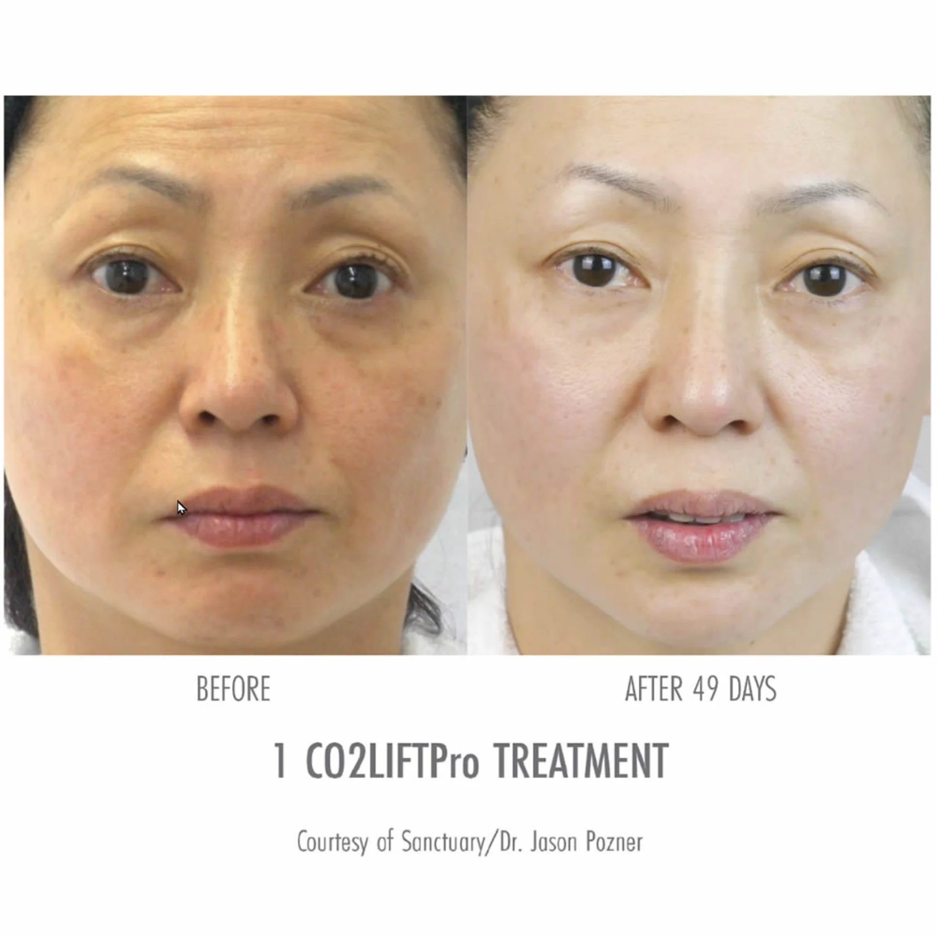 CO2 Lift Pro Park City