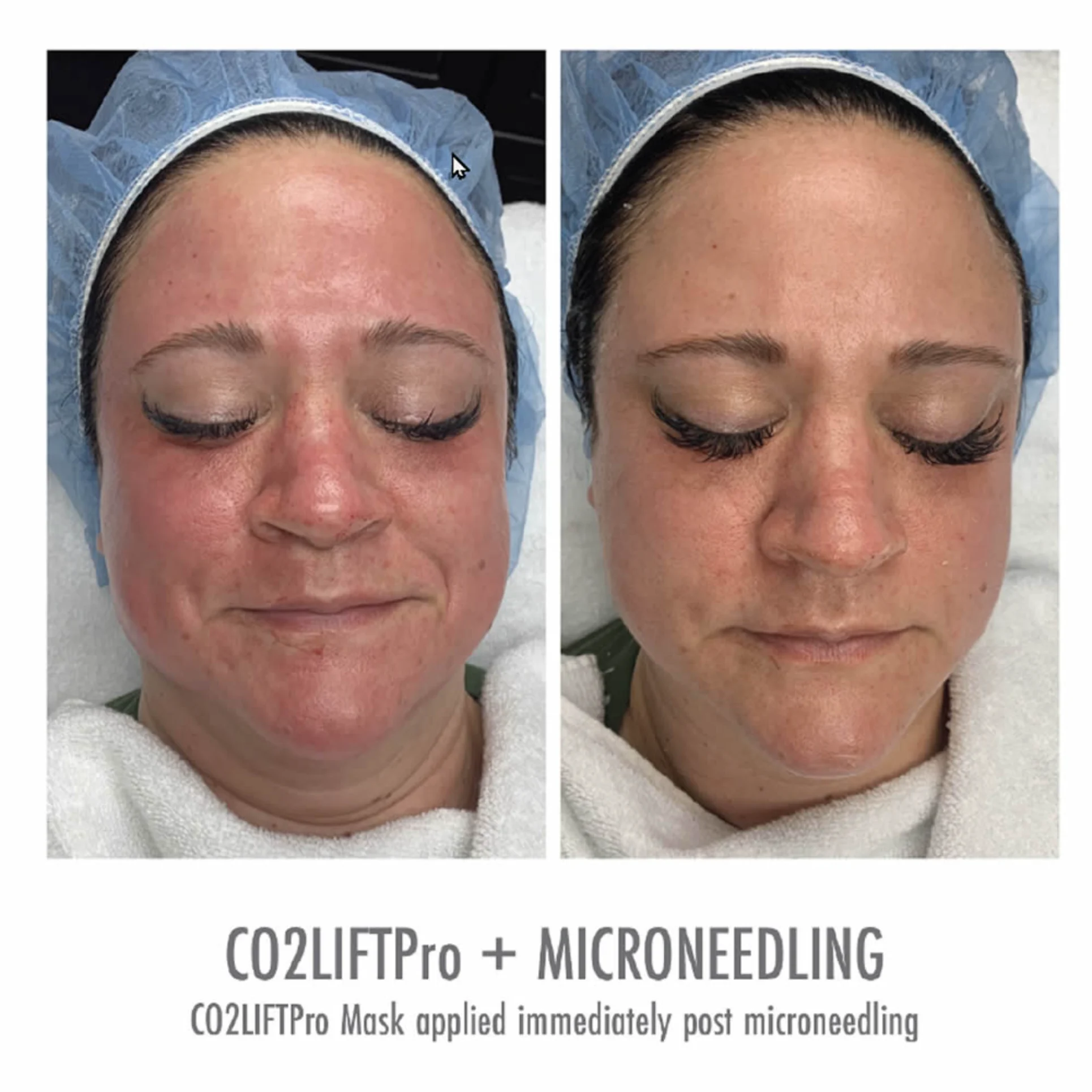 CO2 Lift Pro Park City