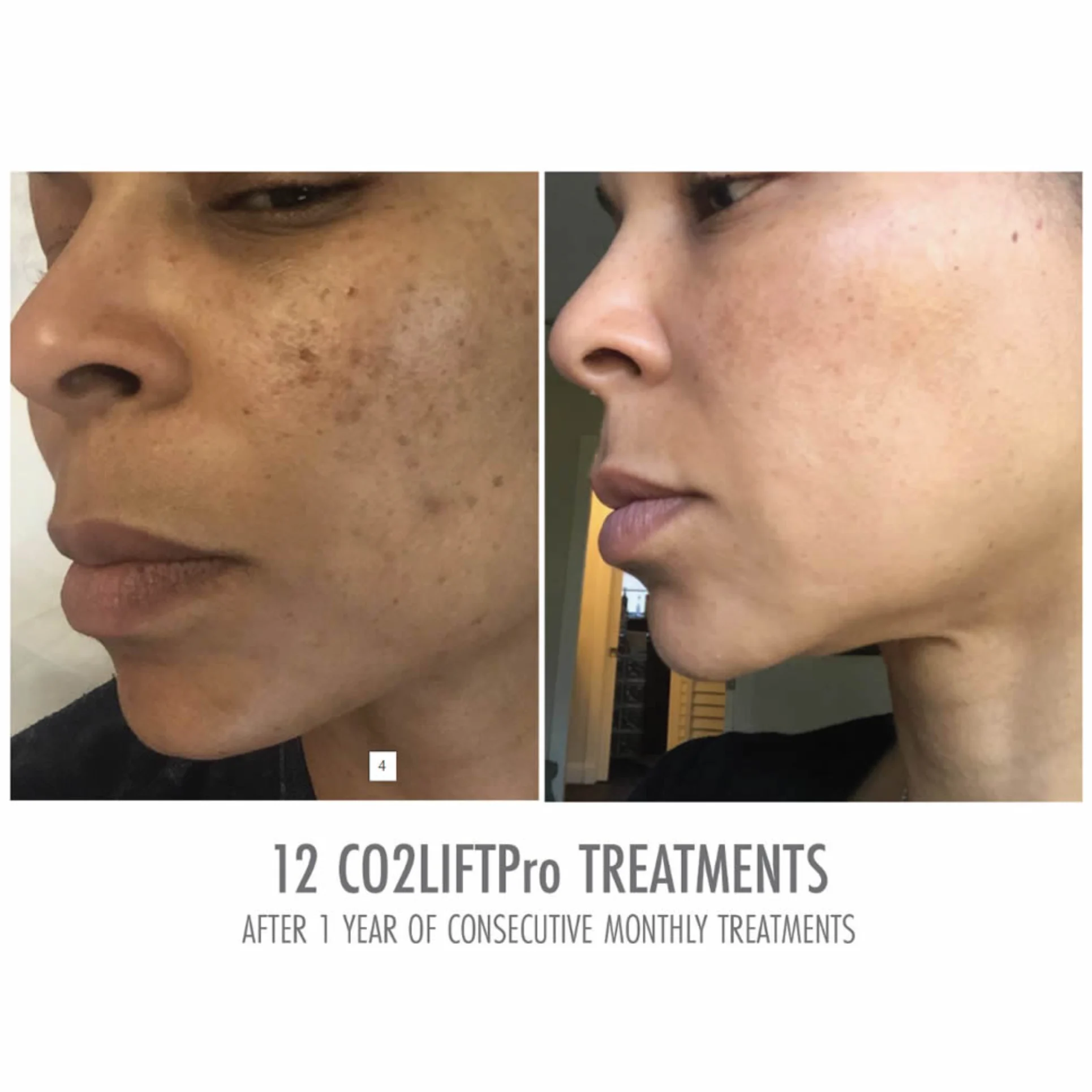 CO2 Lift Pro Park City